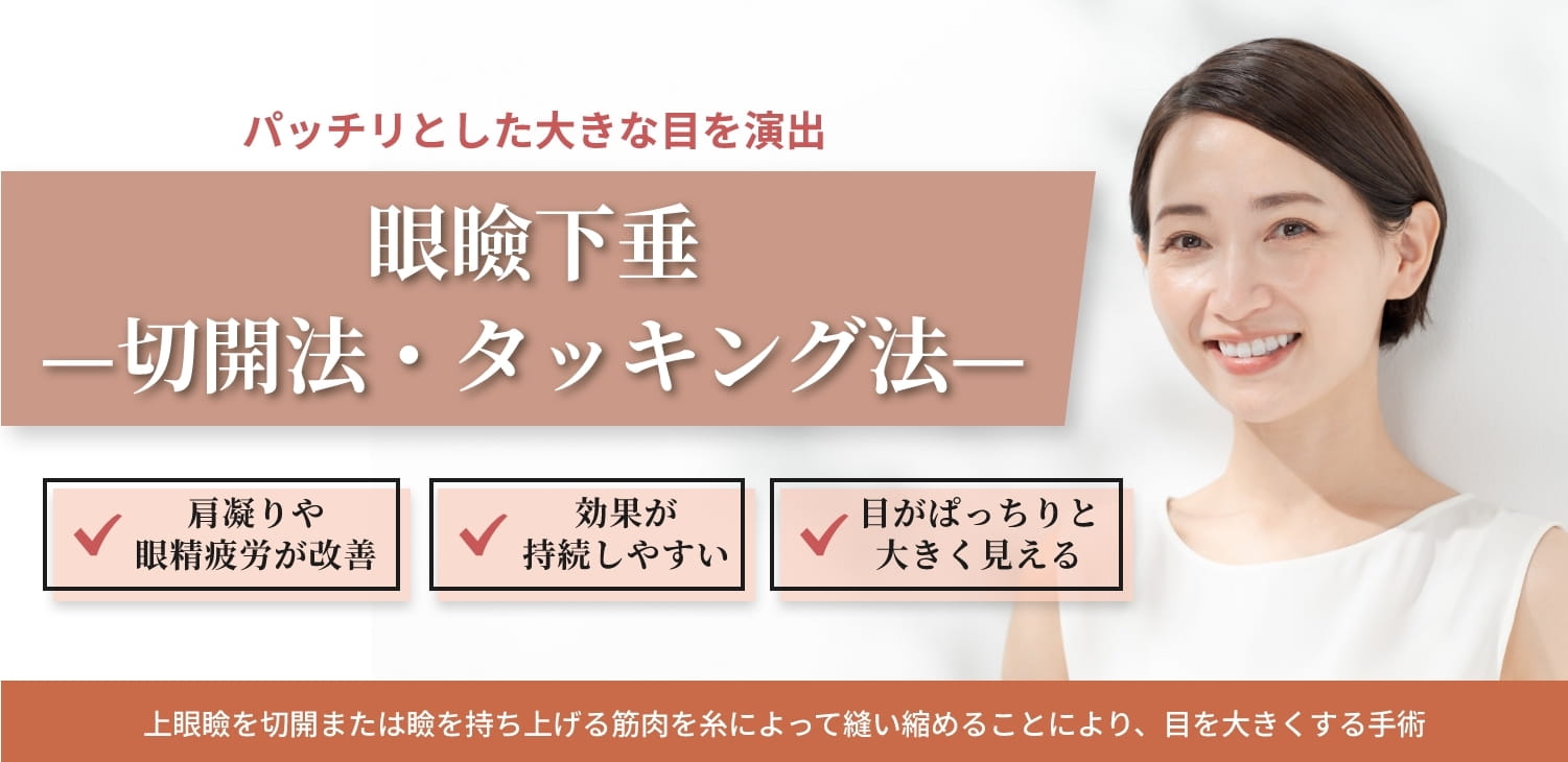 眼瞼下垂 切開法・切らないタッキング法