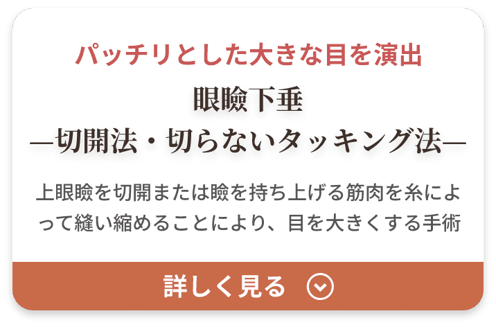 眼瞼下垂 切開法・切らないタッキング法